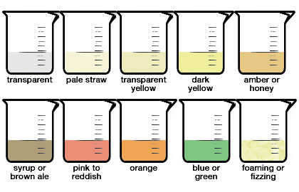 urine-color
